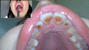 街角のお姉さんのお口の中を拝見