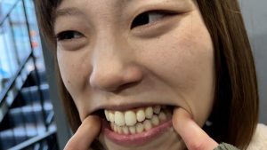 【特価】口腔観察VOL.3 4名59分お買い得セット 【machikado-0126】